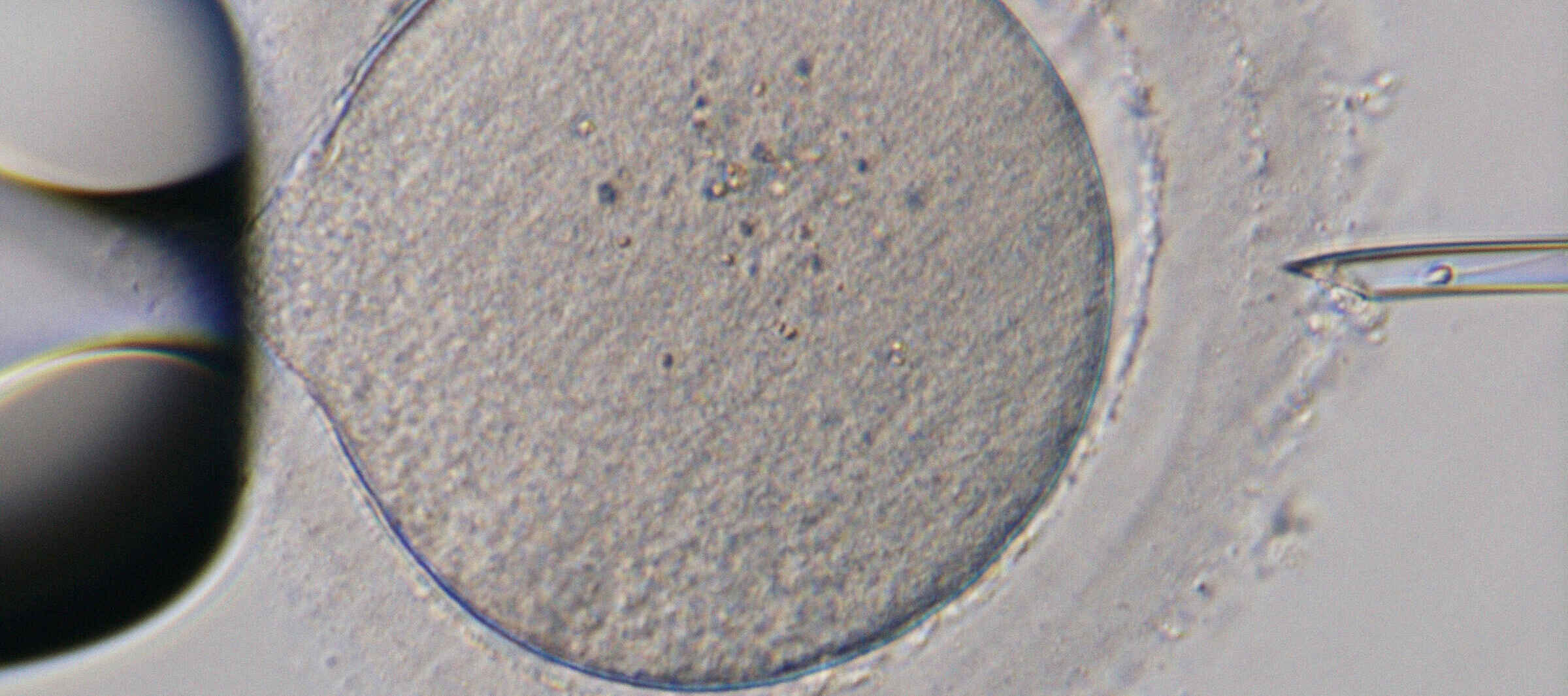 Nikon Mikroskope für klinisches Labor